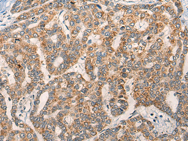 Rabbit Polyclonal Antibody to NLGN1