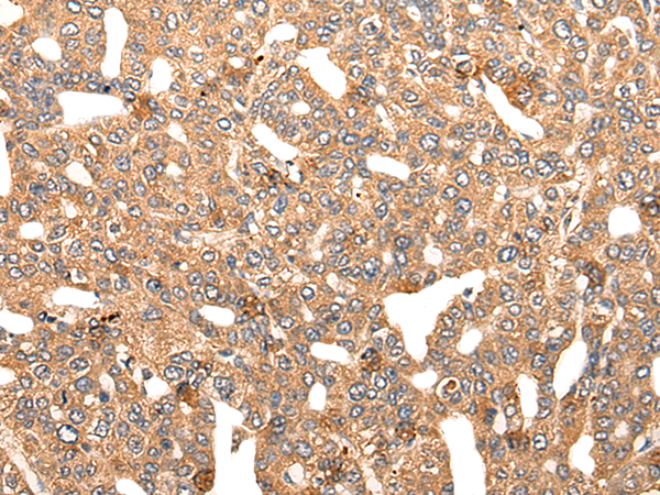 Rabbit Polyclonal Antibody to NOL8