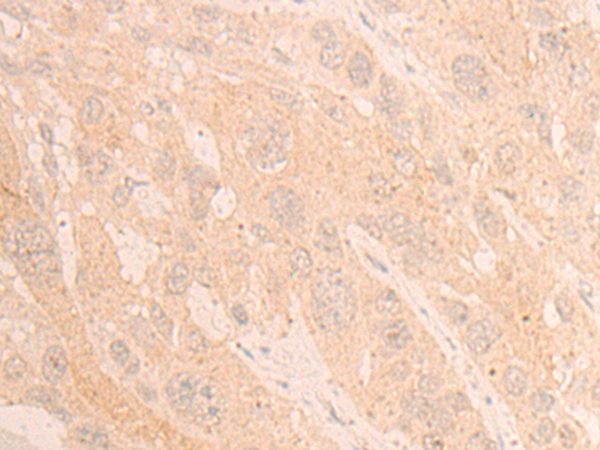 Rabbit Polyclonal Antibody to LTO1