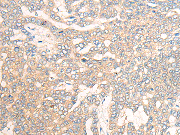 Rabbit Polyclonal Antibody to HCRT(Orexin-B)