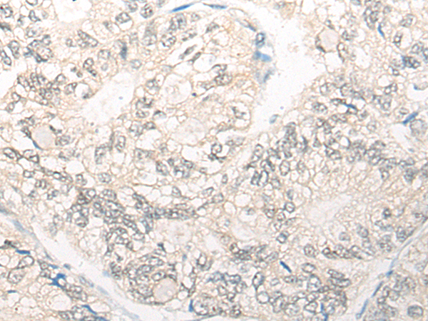 Rabbit Polyclonal Antibody to SP7