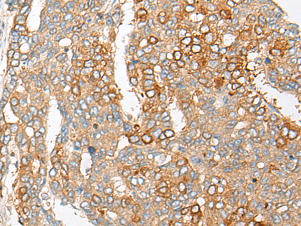 Rabbit Polyclonal Antibody to PCDHGB5
