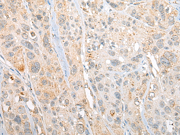 Rabbit Polyclonal Antibody to REM1