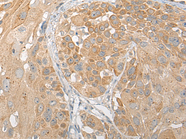 Rabbit Polyclonal Antibody to SNX6