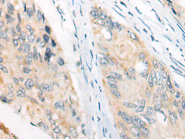 Rabbit Polyclonal Antibody to SLC22A18