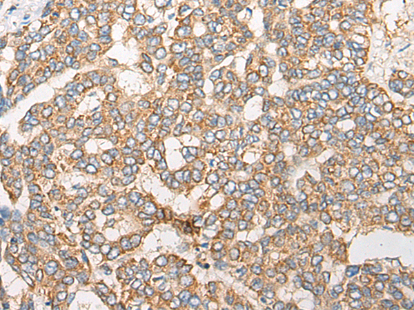 Rabbit Polyclonal Antibody to ARF3