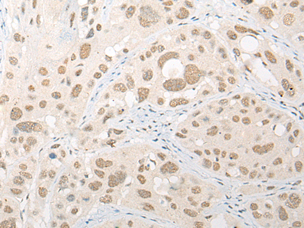 Rabbit Polyclonal Antibody to CASP10