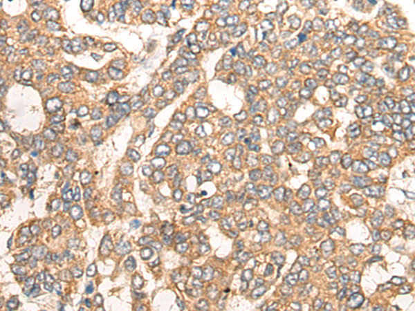 Rabbit Polyclonal Antibody to CCL5