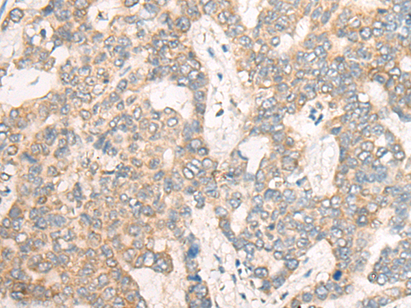 Rabbit Polyclonal Antibody to CSNK1G1
