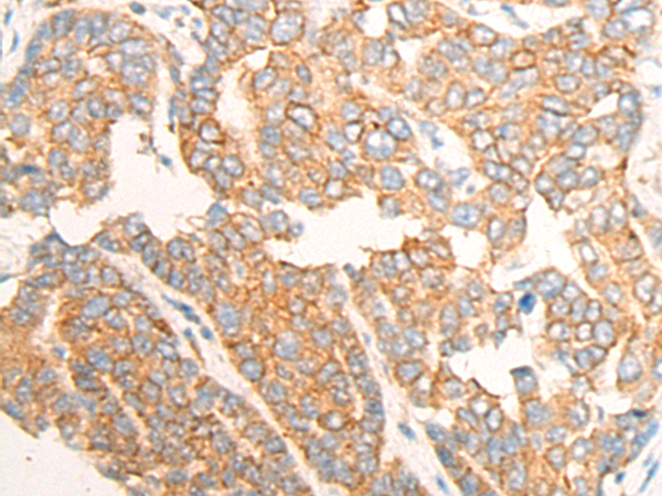Rabbit Polyclonal Antibody to CLEC12A