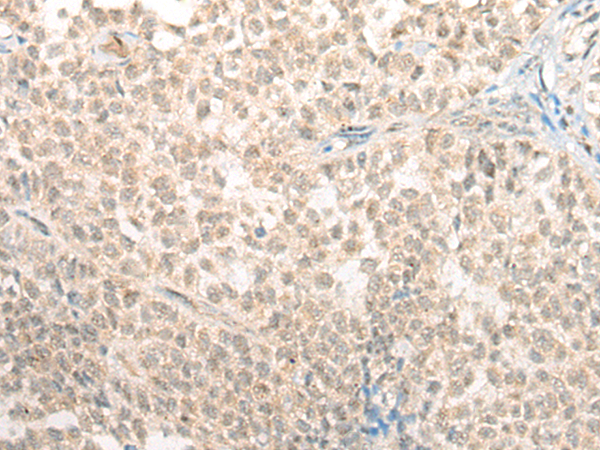 Rabbit Polyclonal Antibody to ETS1
