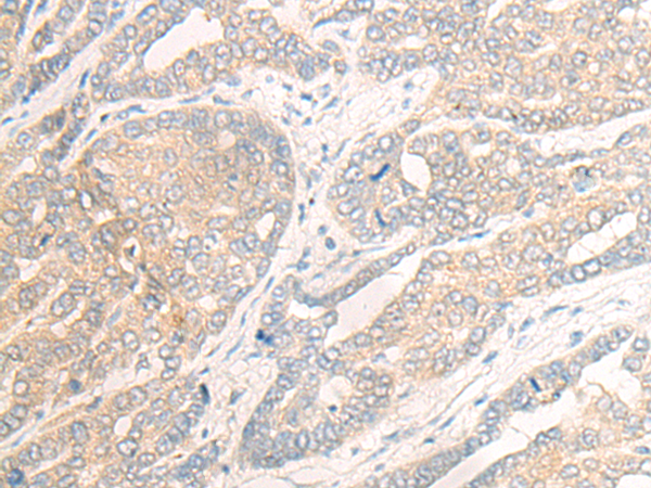 Rabbit Polyclonal Antibody to HOXA1