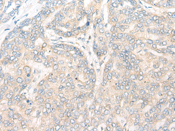 Rabbit Polyclonal Antibody to IL16