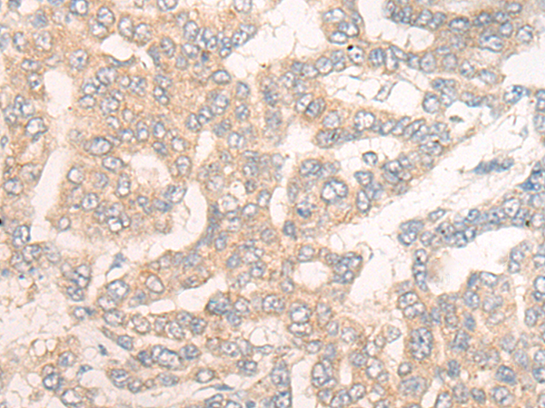 Rabbit Polyclonal Antibody to COX15