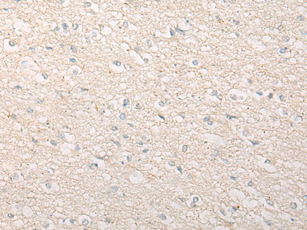 Rabbit Polyclonal Antibody to CCP110