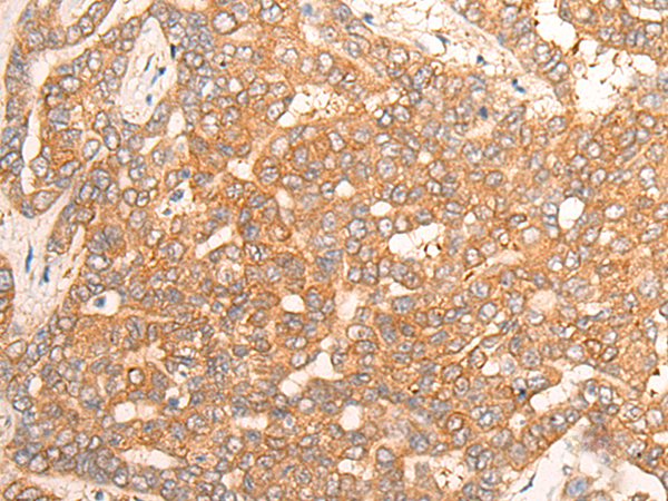 Rabbit Polyclonal Antibody to CPS1