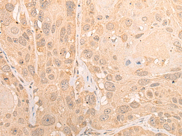 Rabbit Polyclonal Antibody to CPSF2