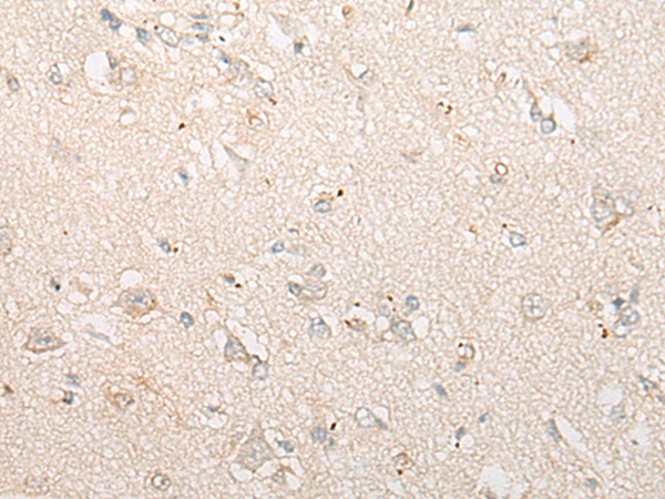 Rabbit Polyclonal Antibody to CRISP1
