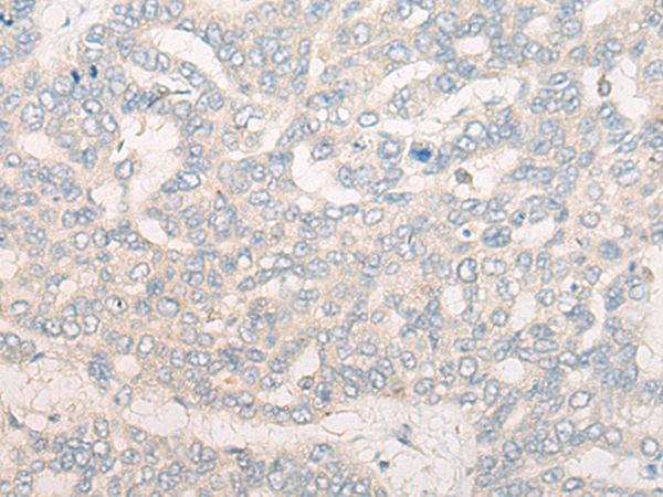 Rabbit Polyclonal Antibody to CR1L