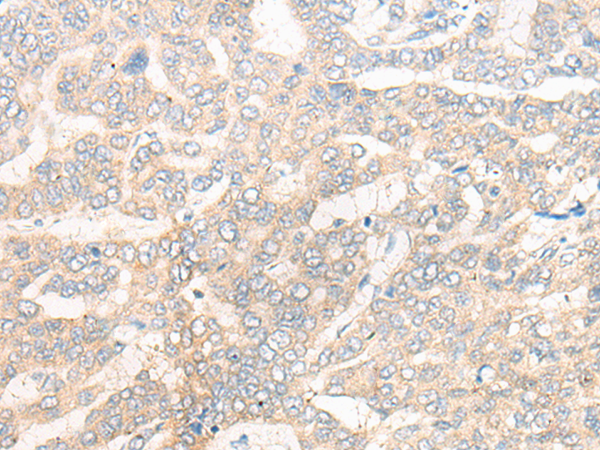 Rabbit Polyclonal Antibody to CYB5R3