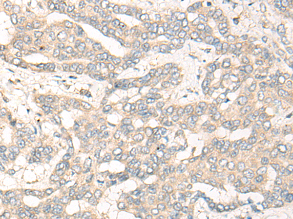 Rabbit Polyclonal Antibody to CCNY