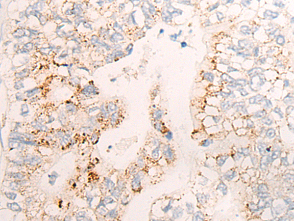 Rabbit Polyclonal Antibody to CYP26C1