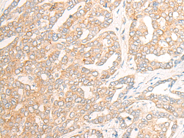 Rabbit Polyclonal Antibody to CYP2C8