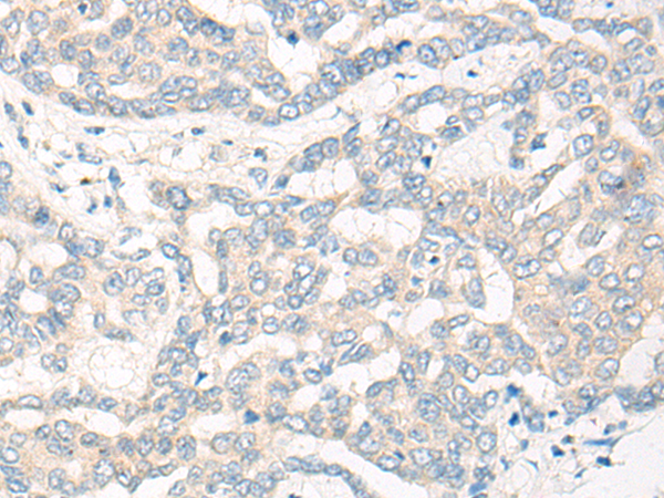 Rabbit Polyclonal Antibody to CYP2R1