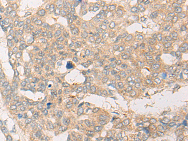 Rabbit Polyclonal Antibody to CYP7B1