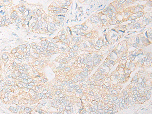 Rabbit Polyclonal Antibody to UQCR10
