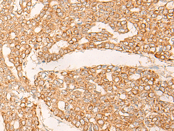Rabbit Polyclonal Antibody to KRT9