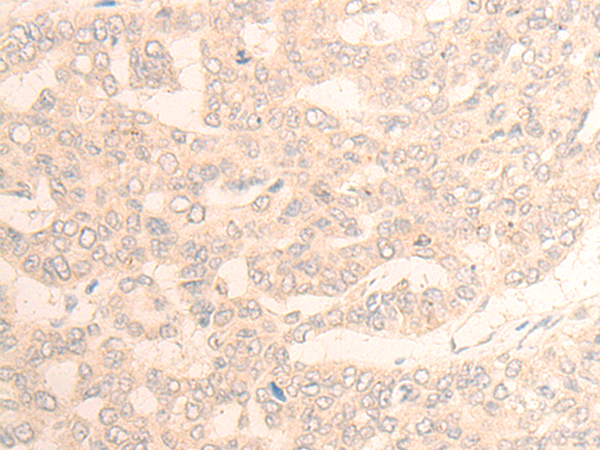 Rabbit Polyclonal Antibody to DAGLB