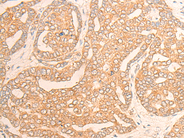 Rabbit Polyclonal Antibody to DAGLA