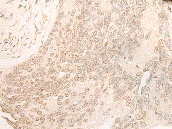 Rabbit Polyclonal Antibody to DACT1