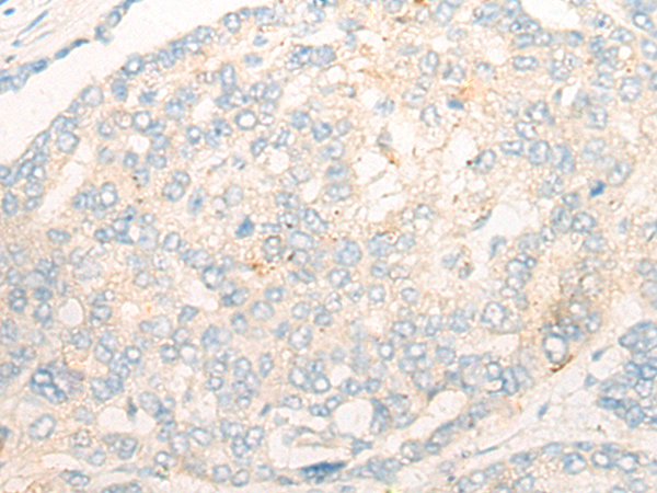 Rabbit Polyclonal Antibody to DAPP1