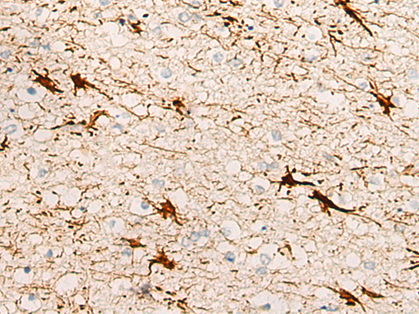 Rabbit Polyclonal Antibody to DBX2