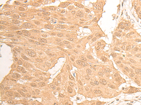 Rabbit Polyclonal Antibody to DCAF13