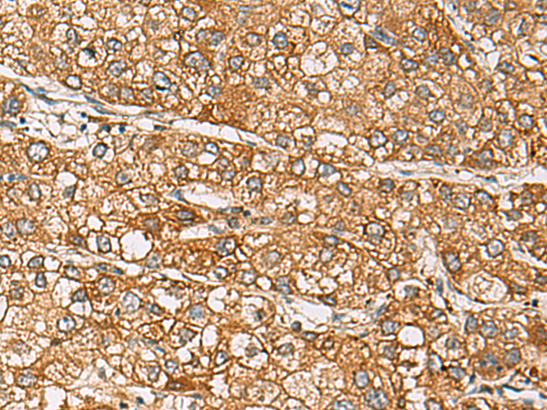 Rabbit Polyclonal Antibody to DCAF12