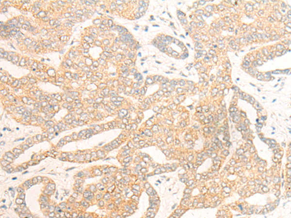 Rabbit Polyclonal Antibody to DCAF5