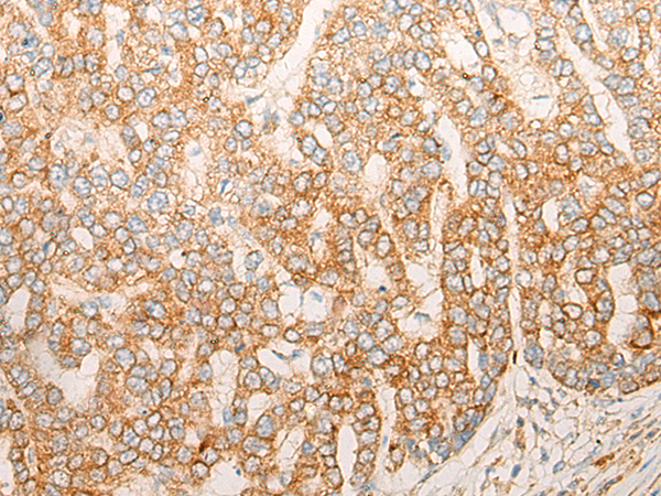 Rabbit Polyclonal Antibody to DEGS1