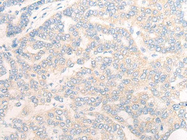 Rabbit Polyclonal Antibody to SLC28A2