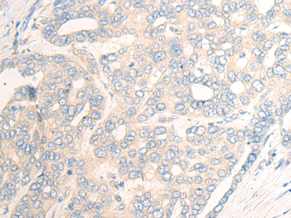 Rabbit Polyclonal Antibody to SLC39A4