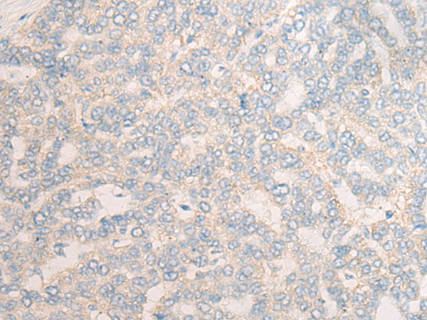 Rabbit Polyclonal Antibody to DKKL1
