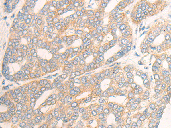 Rabbit Polyclonal Antibody to IL20RB