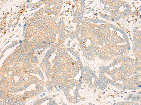 Rabbit Polyclonal Antibody to FBXO32