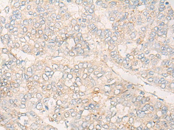 Rabbit Polyclonal Antibody to DMTN