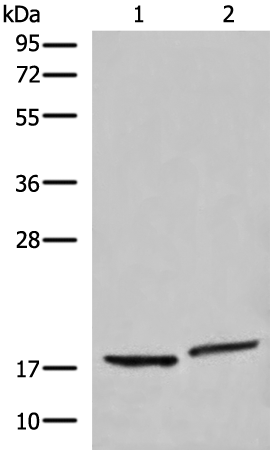 Rabbit Polyclonal Antibody to DENR