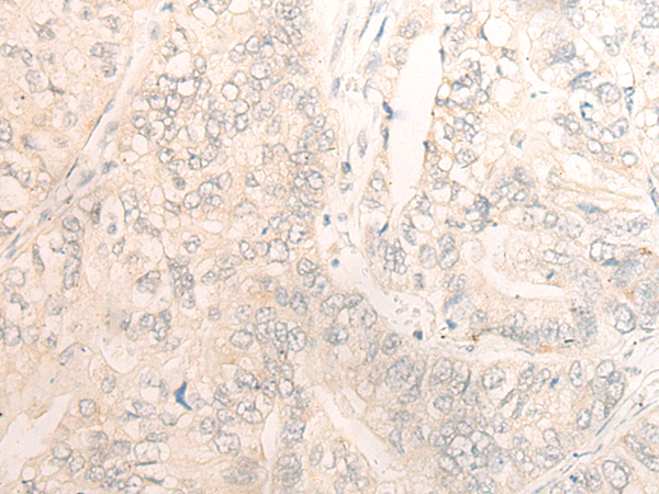 Rabbit Polyclonal Antibody to DSC3