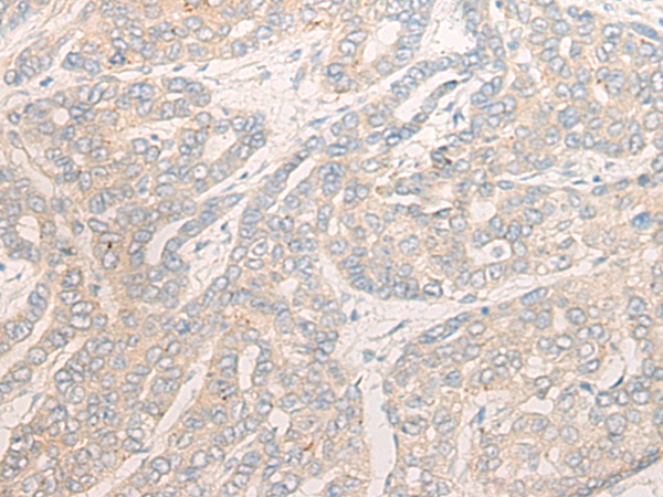 Rabbit Polyclonal Antibody to SYNM