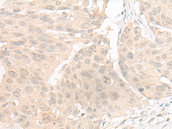 Rabbit Polyclonal Antibody to DGCR6